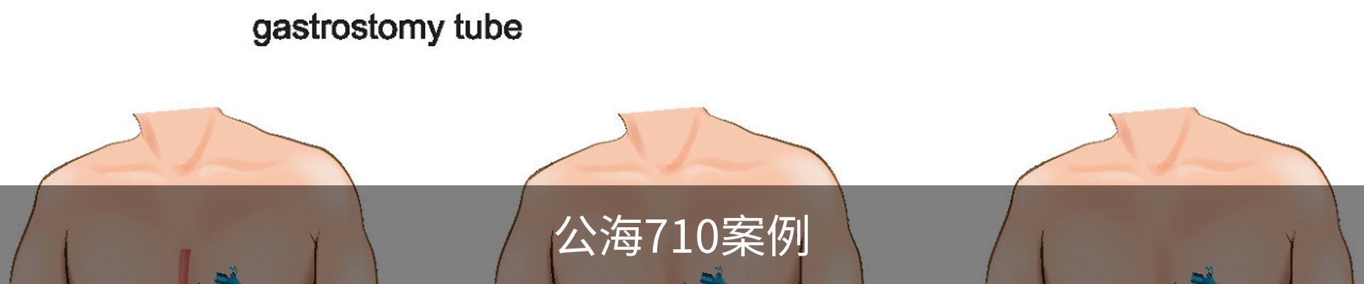 公海710案例